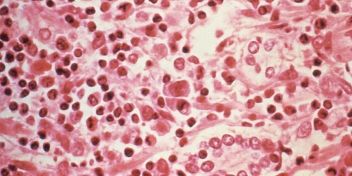 hantavirus-yozI_large